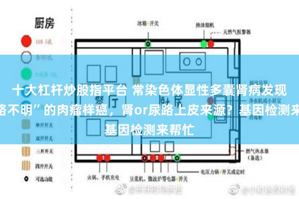 十大杠杆炒股指平台 常染色体显性多囊肾病发现“来路不明”的肉瘤样癌，肾or尿路上皮来源？基因检测来帮忙